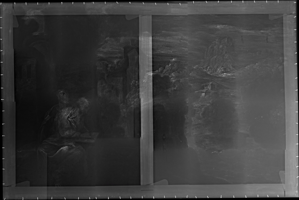 Radiografía completa 